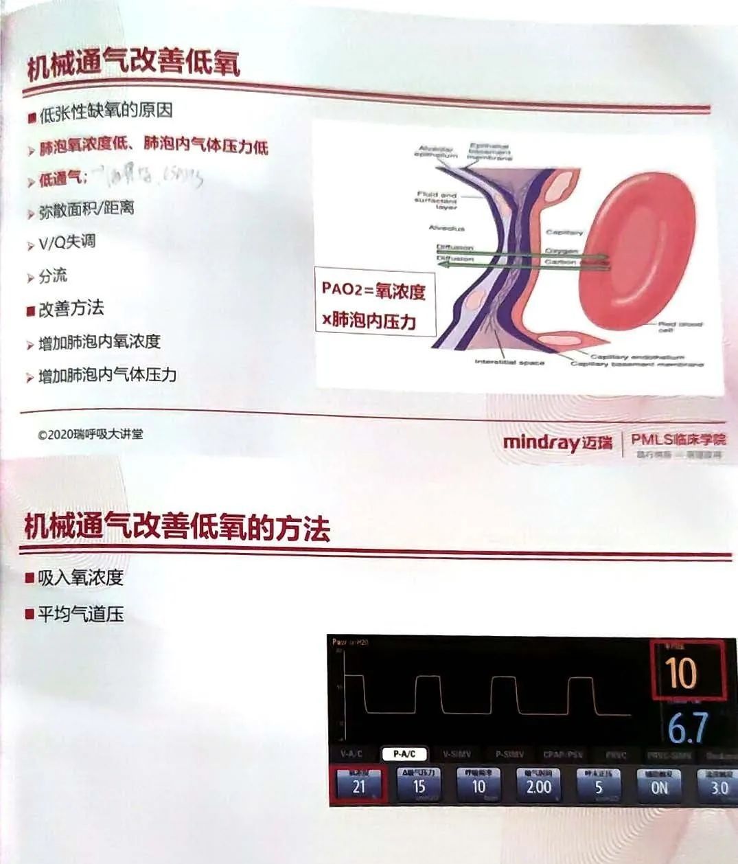 如何设置和调节呼吸机