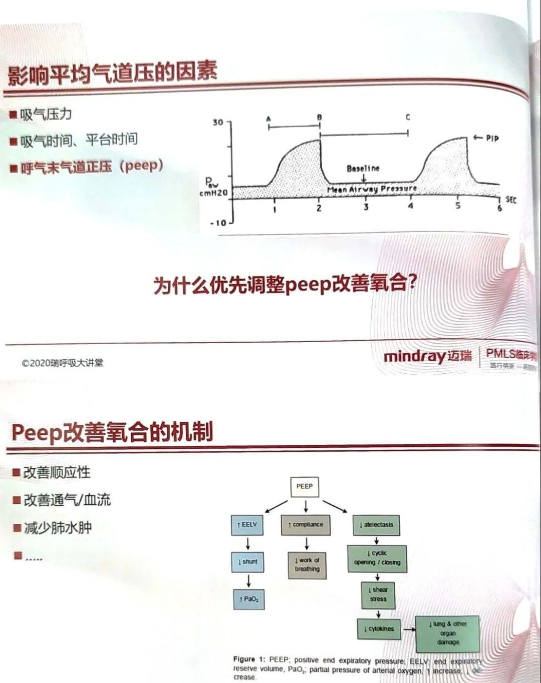 如何设置和调节呼吸机