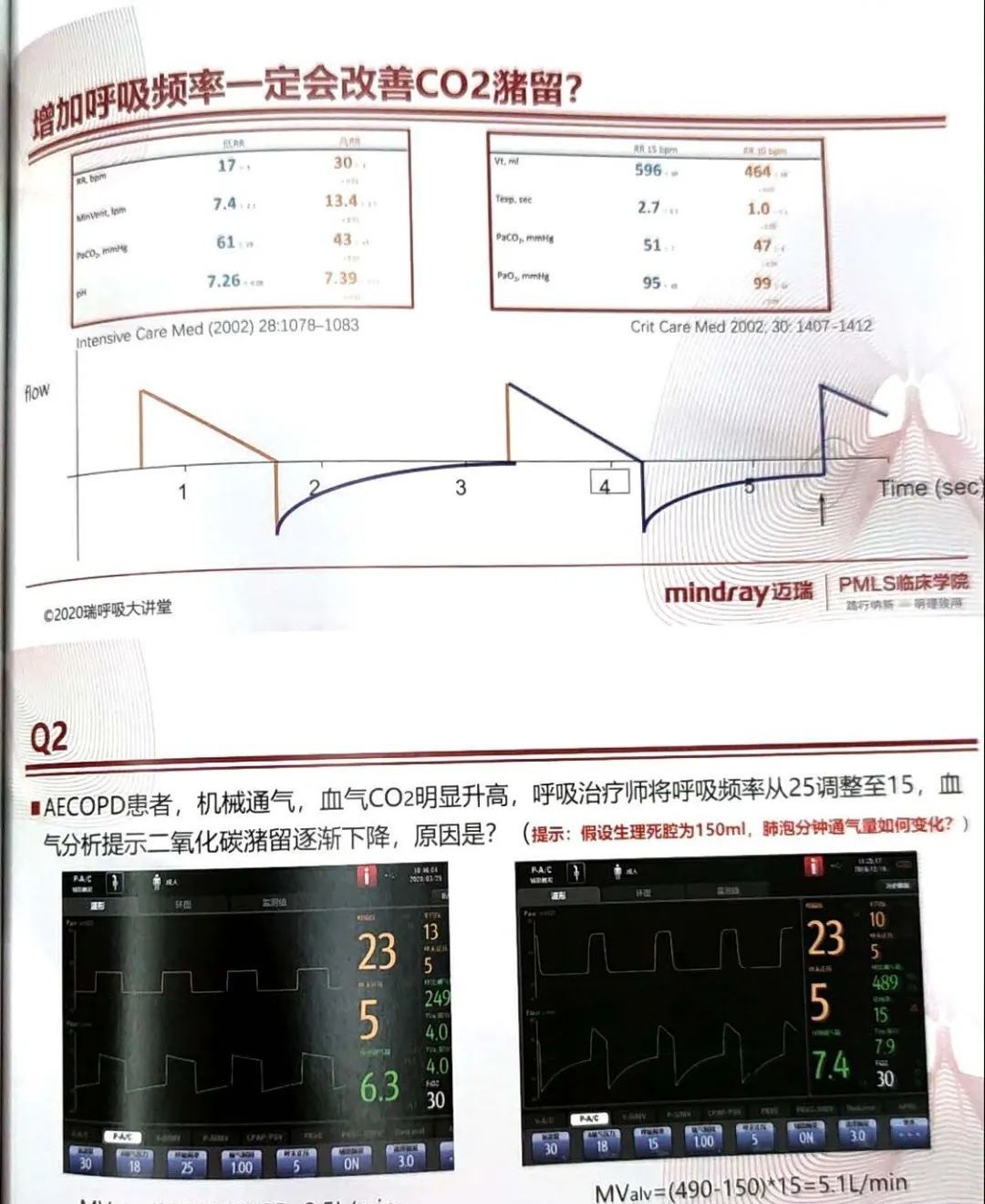 如何设置和调节呼吸机