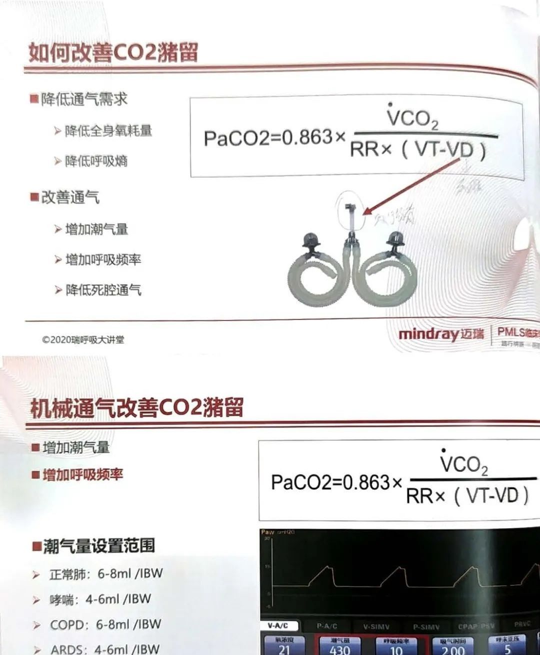 如何设置和调节呼吸机