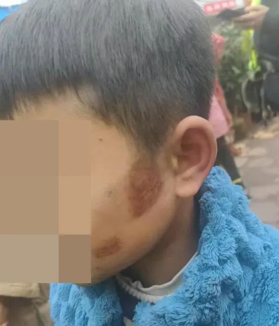 寒假交通安全 | 儿童路边玩耍进入“车辆盲区”被轧,寒假家长要警惕!