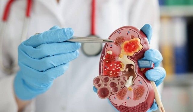 泌尿感染患者抗菌药物选择，药物敏感性，治疗周期需合理