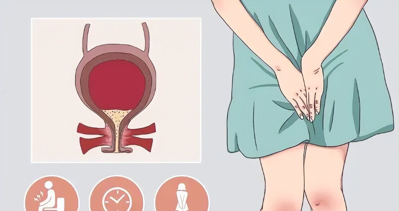 聊聊尿路感染那点事儿：不吃左氧氟沙星，还有什么别的方法吗？