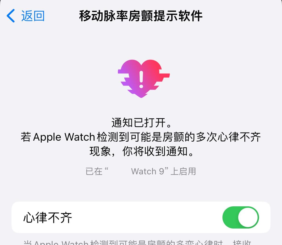 Apple watchOS 10.1带来了Tap手势和房颤心律不齐提醒