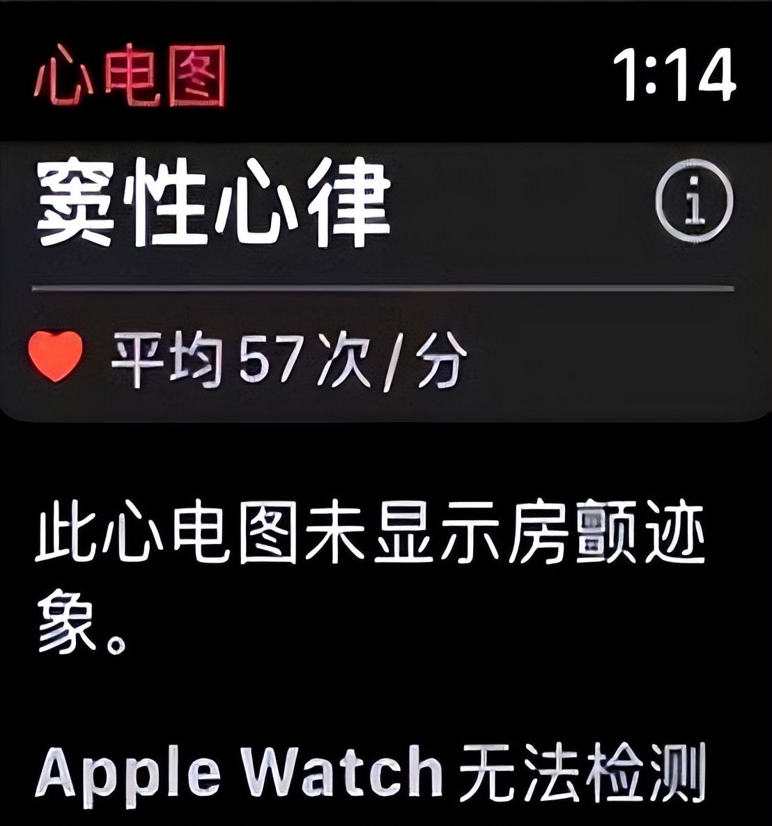 iPhone Watch的25个实用功能，掌握等于白买！