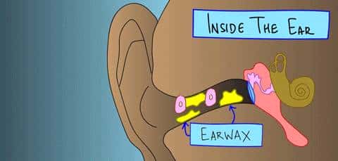 给娃上医院掏耳屎花了5000块！平时应该怎么给娃掏耳屎？