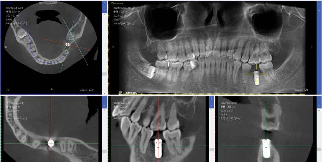 用800块过上理想生活、花50w“重启人生”，她们说这是今年花得最值的一笔钱！