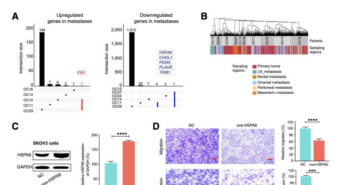 单细胞多组学揭示高浆卵巢癌的分子调控机制