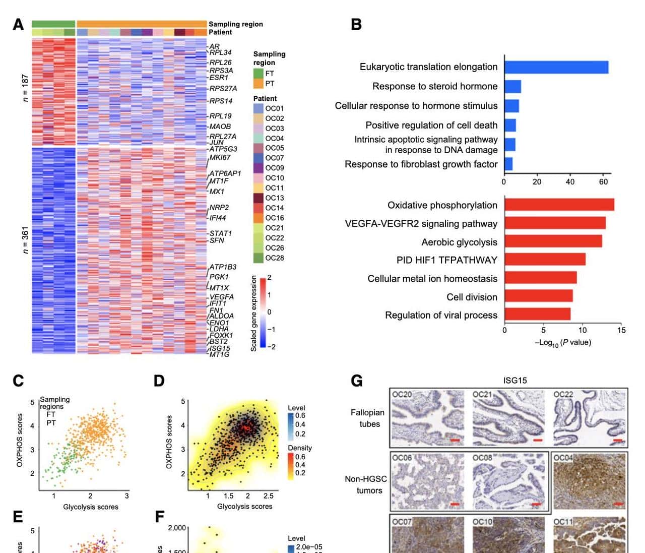 单细胞多组学揭示高浆卵巢癌的分子调控机制