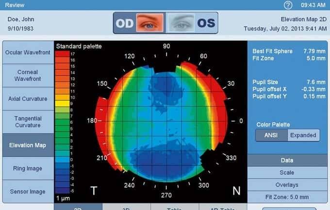 眼镜才是本体——哪些眼镜最有性价比，配镜实用攻略