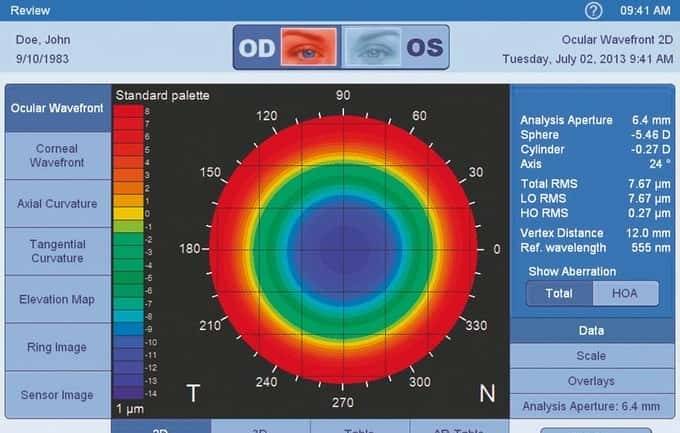 眼镜才是本体——哪些眼镜最有性价比，配镜实用攻略