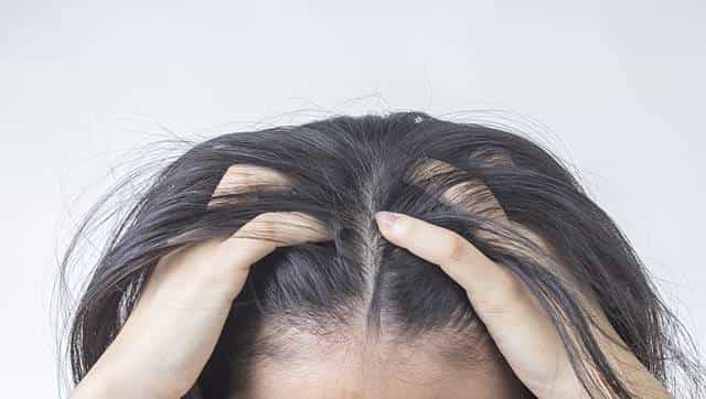 头发稀少头皮可见？别急着买昂贵产品！这个土方法，一用就惊喜！