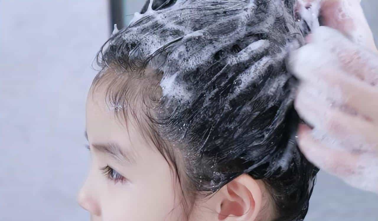 35岁男子头发稀疏，查成分发现罪魁祸首，90家庭都在用