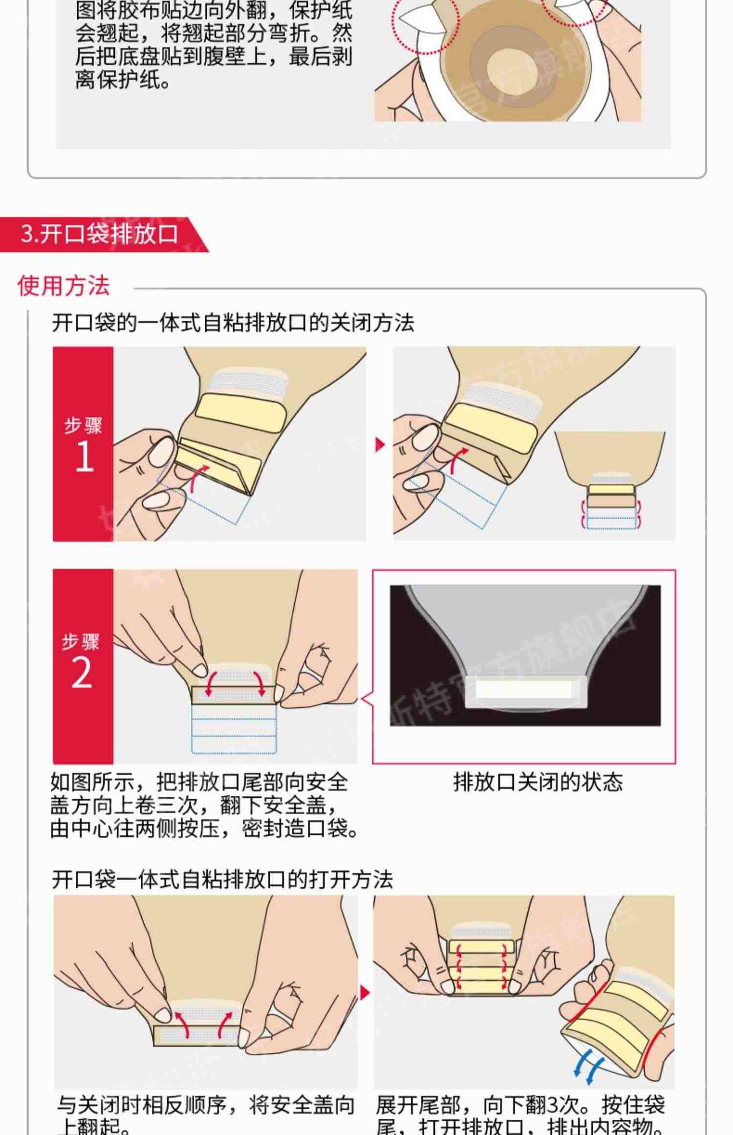 【好利斯特】两件式造口袋造瘘袋肠造口18193/18194/18183/18184