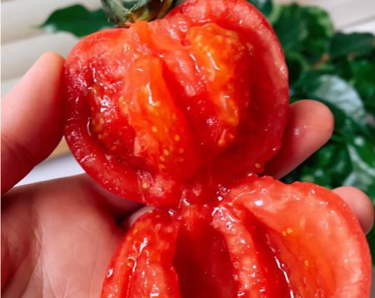 如何去法令纹？ - 宋马